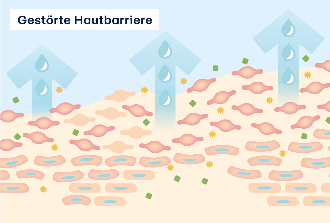 Auf dem Bild zur gestörten Hautbarriere sieht man ebenfalls eine Illustration eines Querschnitts der Haut. Hier ist dargestellt, wie Schadstoffe die Hautbarriere aus dem Gleichgewicht bringen.