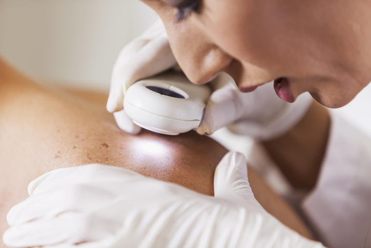 Dermatologin macht Hautuntersuchung bei einem Patienten Dermatologin macht Hautuntersuchung bei einem Patienten