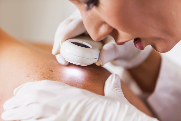 Dermatologin macht Hautuntersuchung bei einem Patienten