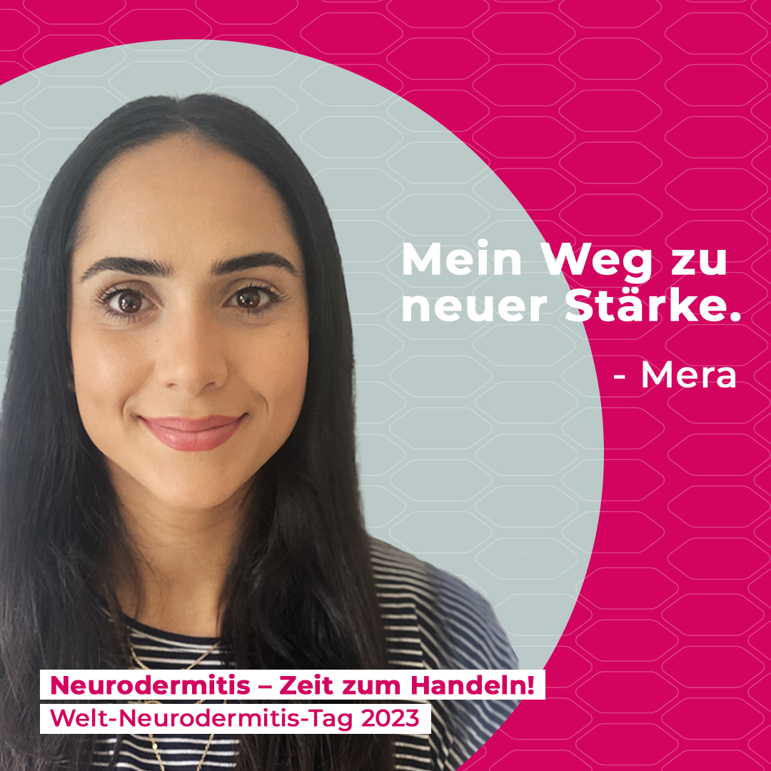 Mera erzählt von ihren Erfahrungen mit Neurodermitis