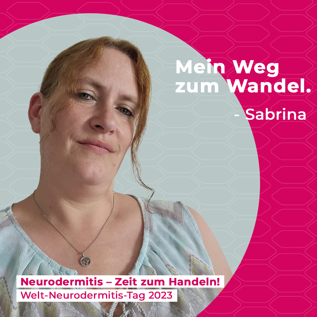 Sabrina erzählt von ihren Erfahrungen mit Neurodermitis